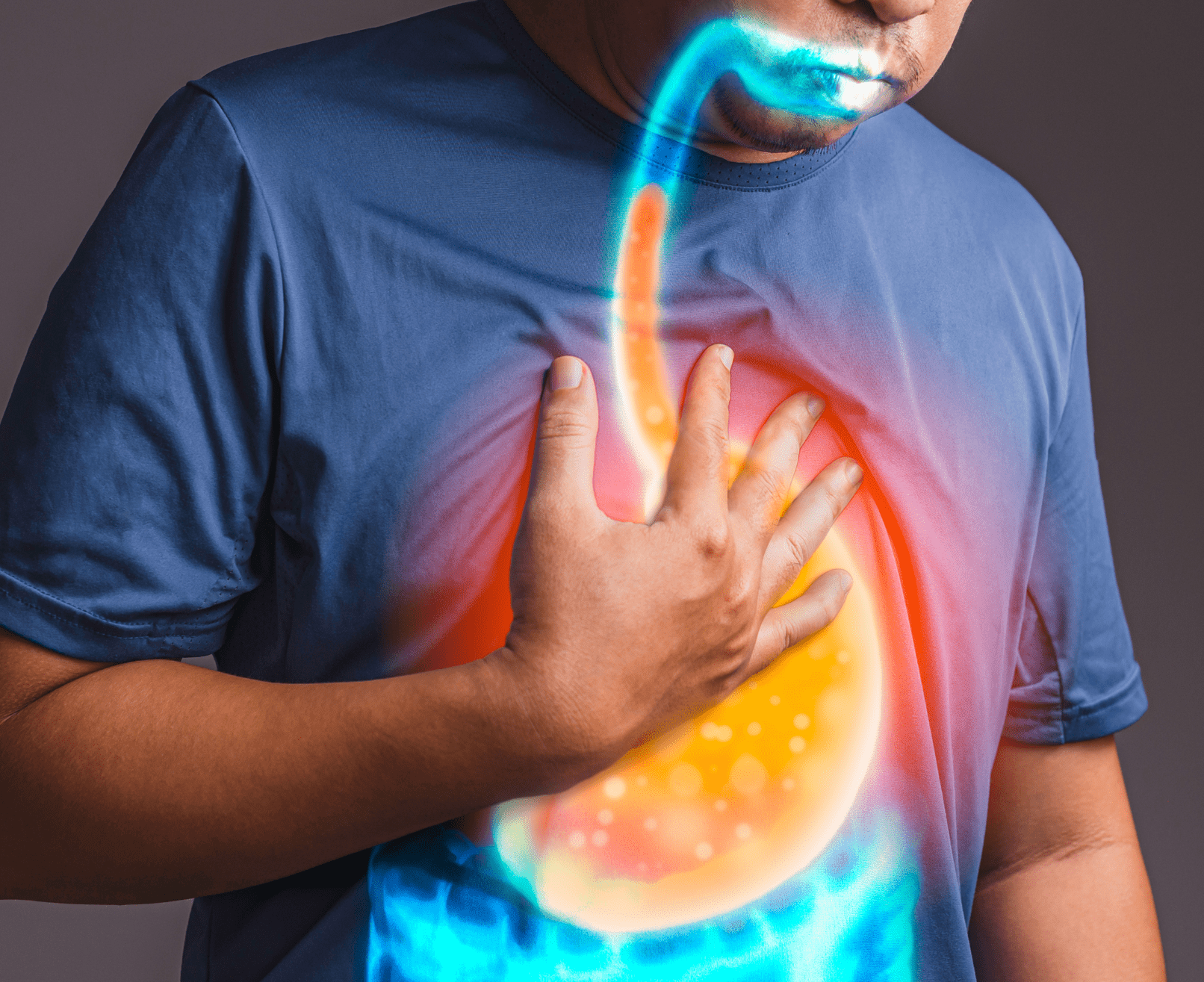 GERD & Hiatal Hernia - Schoolcraft Memorial Hospital