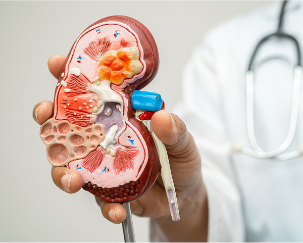 Nephrology 